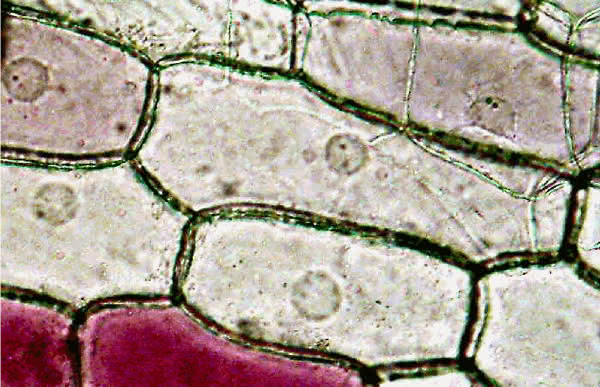 Zellkerne in Zweibelzellen - Lichtmokroskopie