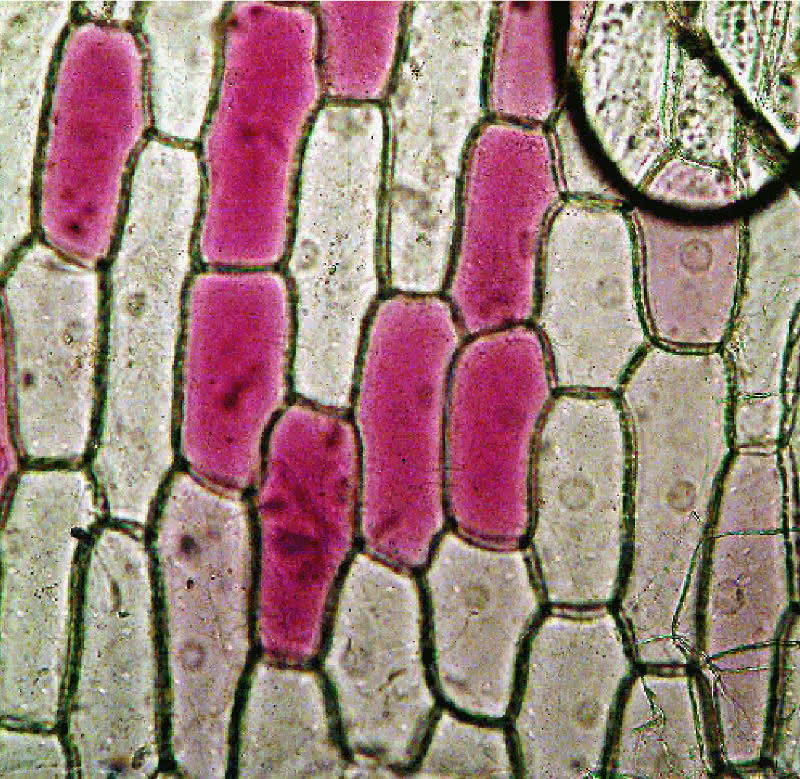 Zellkern in Zwiebelzellen - lichtmirkroskopische Aufnahme
