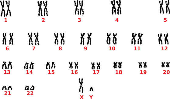 Mann frau karyogramm unterschied und Karyogramm (Chromosomenanalyse)