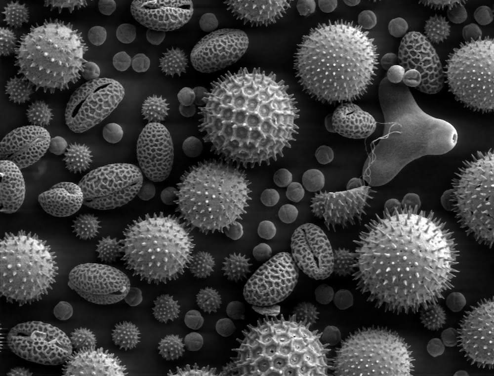 Pollen im Elektronenmikroskop