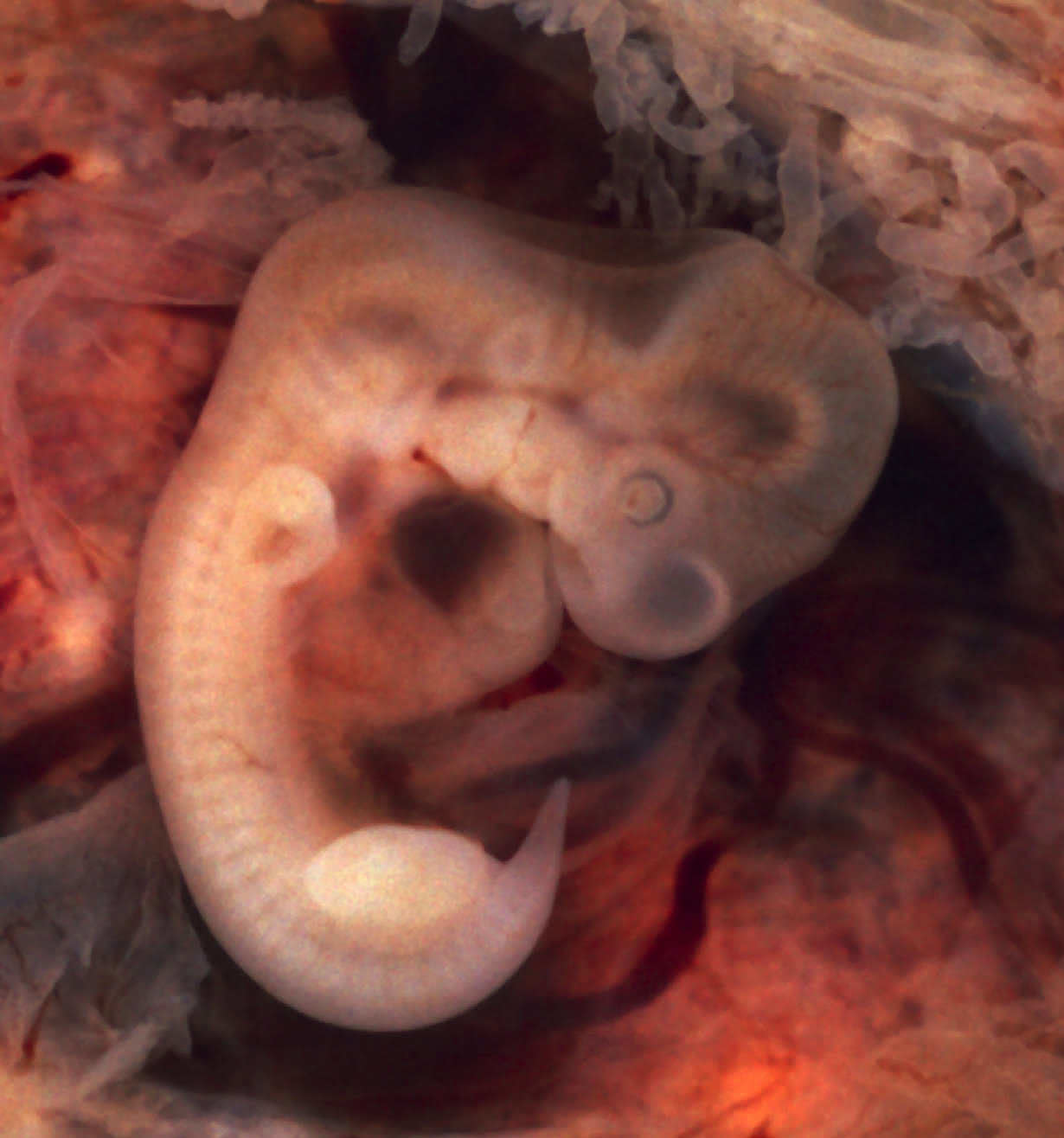 Embryo in der z. Woche