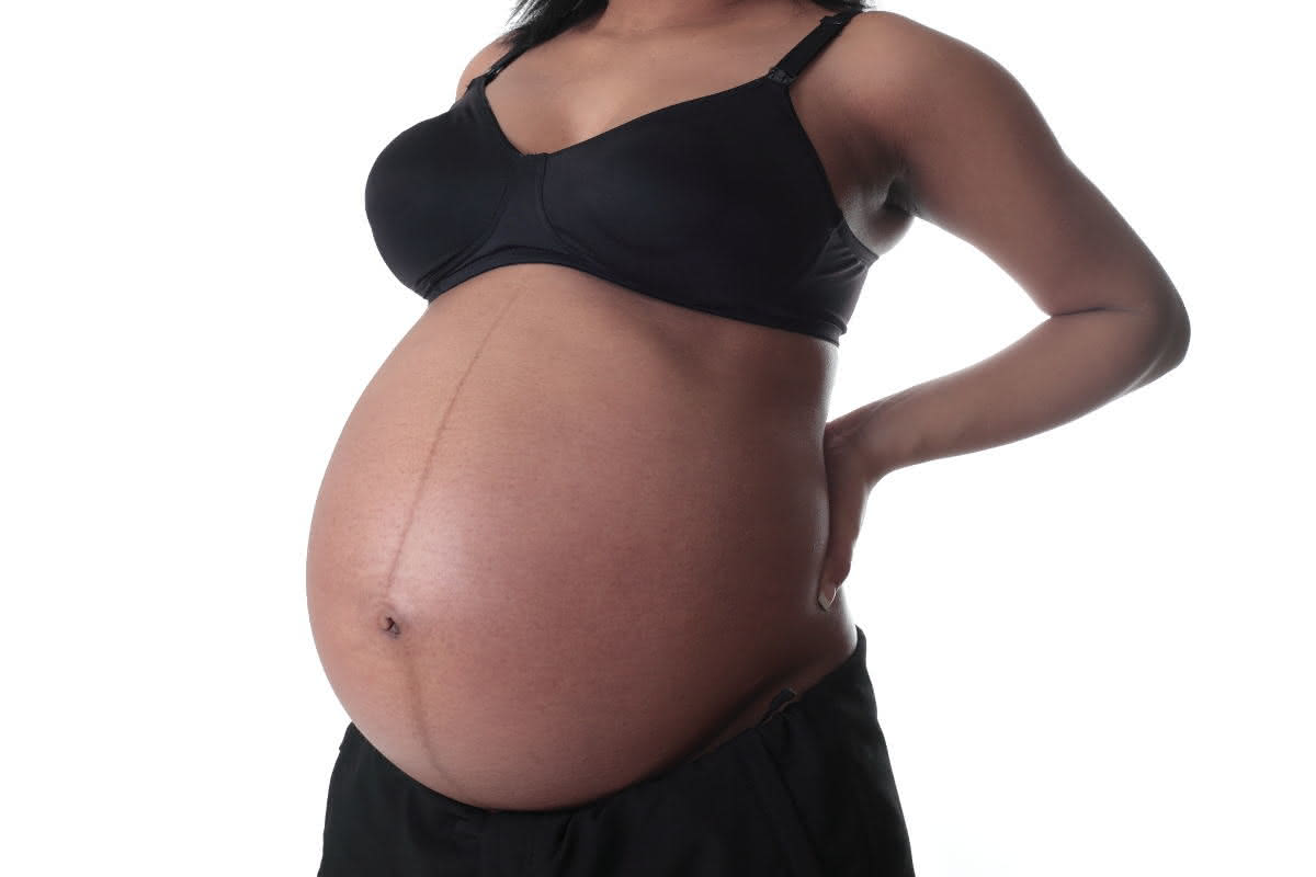 Linea Negra einer Frau während der Schwangerschaft