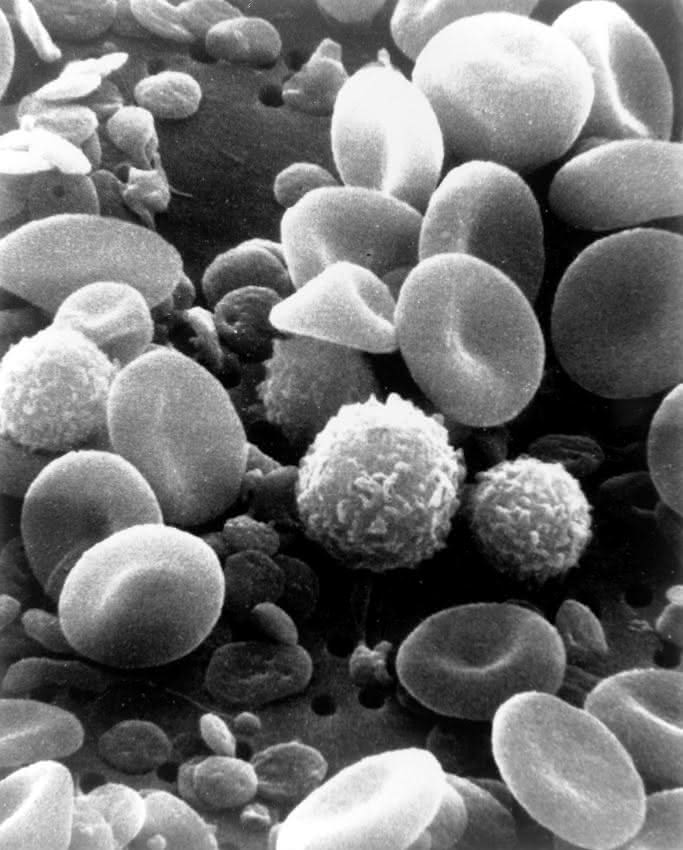 Blutzellen, Elektronenmikroskopische Aufnahme, EM